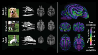 Some of the subtle differences in brain anatomy spotted by Hecht and her team.